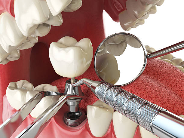 Best Emergency Treatment for Dental Infections or Abscesses in Waterflow, NM